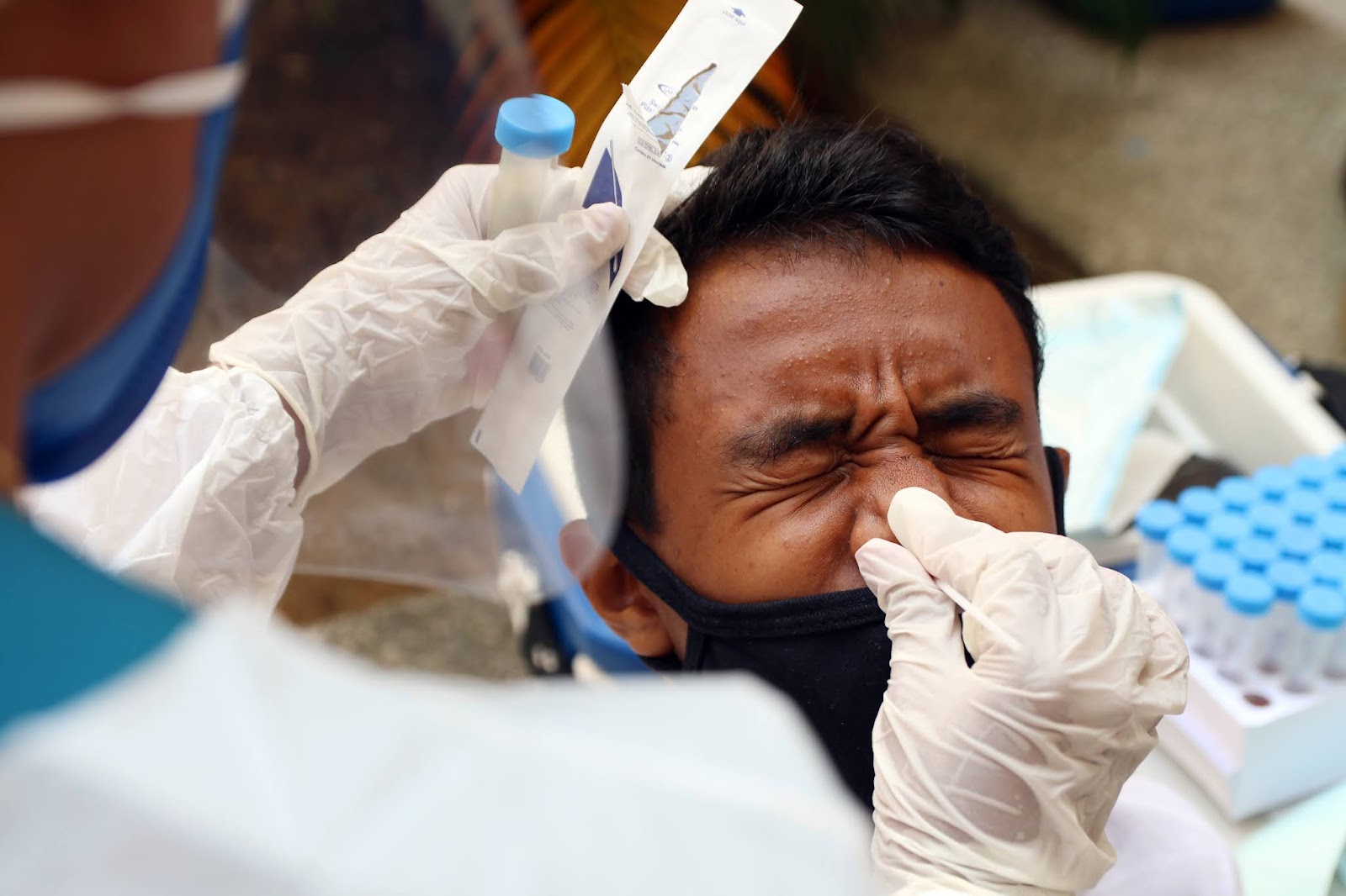 Projeto Partiu! #Testagem nas Escolas tem 98,4% das amostras negativas para Covid-19