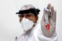 Bahia é selecionada para representar estados do Nordeste em evento nacional sobre vírus respiratórios