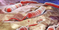Sesab divulga recomendações após bactéria causadora da Cólera ser detectada em amostras de água em Feira de Santana