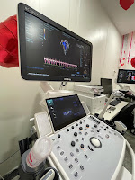 Agora obrigatório, ecocardiograma fetal já é realizado na Bahia gratuitamente há quase um ano